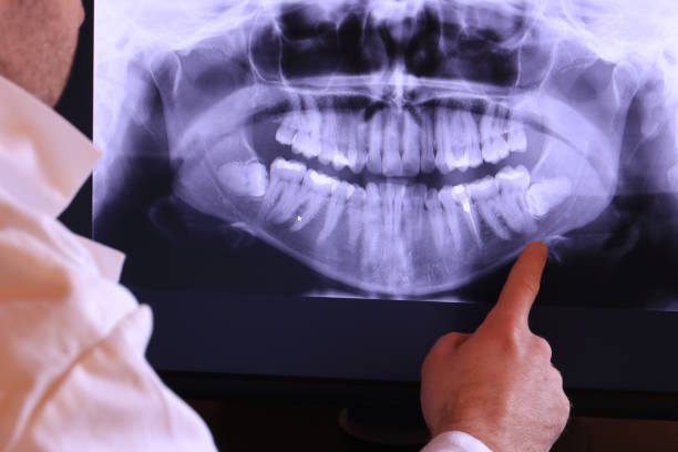 Best Weekend Emergency Dental Services in Breckenridge, TX