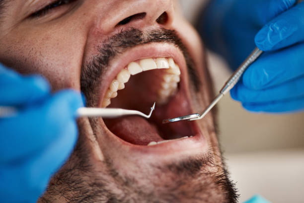 Best Emergency Dental Care for Sports Injuries in Breckenridge, TX